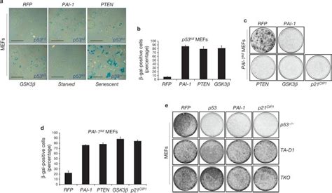Plasminogen activator inhibitor-1 is a critical downstream target of ... 