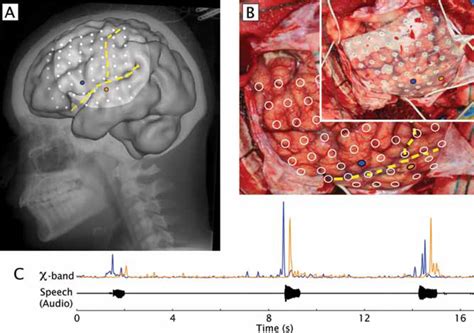 relationship  function  anatomy     anatomy
