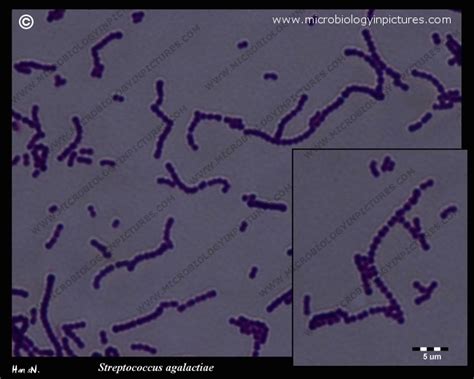 Microscopy Of Streptococcus Agalactiae Gram Positive Cocci