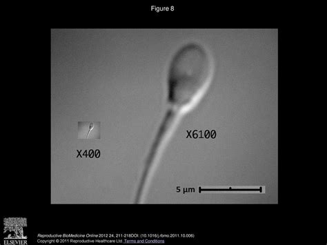 Correlation Between Dna Defect And Sperm Head Morphology Ppt Download