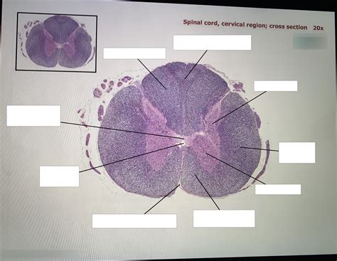 spinal cord cervical region 20x (histology) Diagram | Quizlet