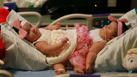 Conjoined Twins Married To One Man