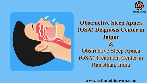 Obstructive Sleep Apnea Osa Diagnosis Center In Jaipur Asthma Bhawan