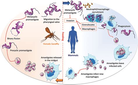 Leishmaniasis Types