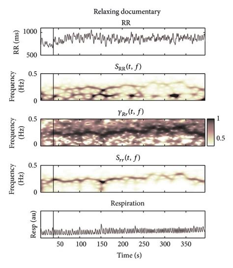 Example Of RR Interval Series RR And Respiratory Resp Signal And