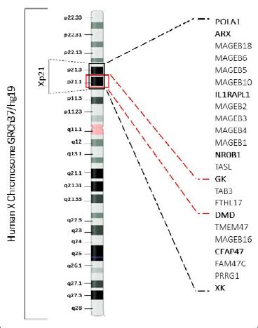 Xp Contiguous Gene Deletion Syndrome Presenting As Duchenne Muscular