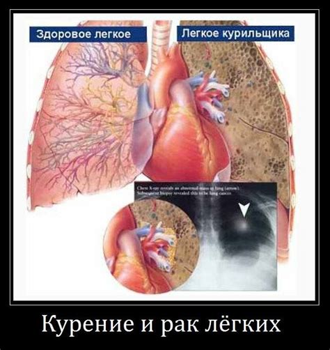 причудливые летчики: как очистить легкие после курения?