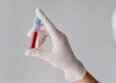 Novo exame de sangue é promessa para detectar antes câncer de cólon