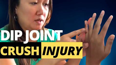 Crush Injury To The Dip Distal Interphalangeal Joint Evaluation