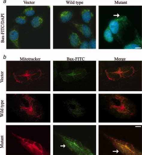 Distribution of Bax protein into the cytoplasm of CYTB transfected ... 