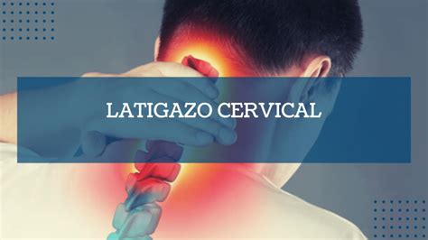 Latigazo Cervical Irf La Salle Centro De Rehabilitaci N Aravaca