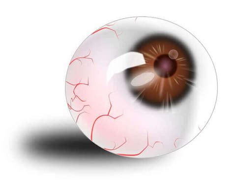 Stroke In Eye: 3 Types, Causes, And Symptoms » 2021