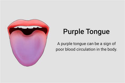 13 Things Your Tongue Can Indicate About Your Health