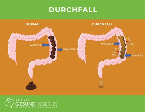 Durchfall Naturheilpraxis Gesund In Berlin