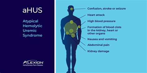 Alexion Pharmaceuticals U S On Twitter Atypical Hemolytic Uremic