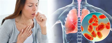 5 Home Remedies For Pneumonia Symptoms Health Gadgetsng