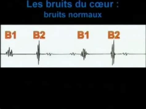 Auscultation Cardiaque Les Bruits Normaux Du C Ur Video Dailymotion