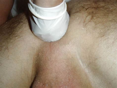 Bdsm Extreme Insertions Urethral Anal Femdom Nude Pics XHamster