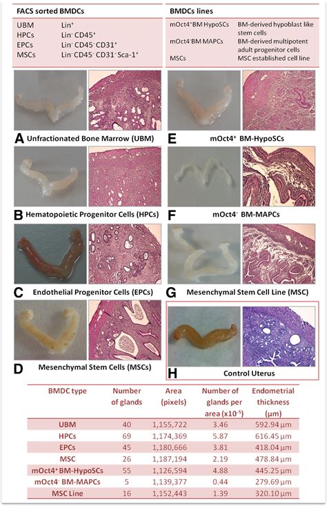 Contribution Of Different Bone Marrow Derived Cell Types In Endometrial