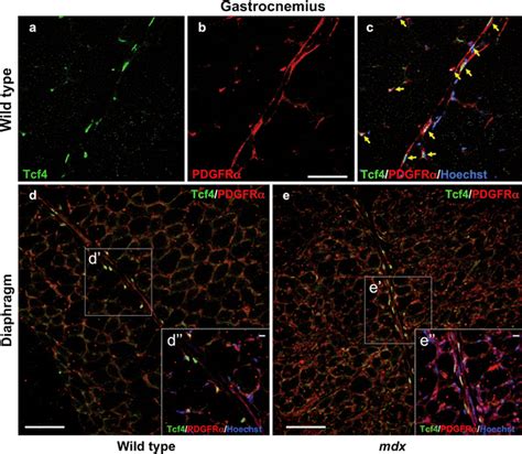 Tcf4 and PDGFR α markers are co expressed in the same interstitial cell