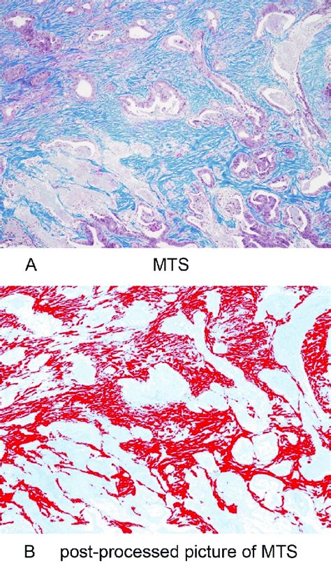 Original And Post Processed Images Of Masson S Trichrome Staining A