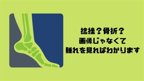 足首の捻挫骨折画像より生物見ましょ アスリートケア整骨院