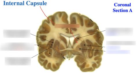 Basal nuclei: 3 Diagram | Quizlet