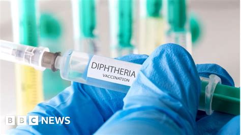 Two Cases Of Deadly Diphtheria Detected In Lothian Area Bbc News