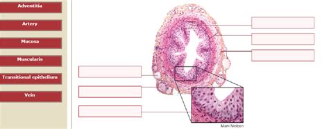 Solved Adventitia Artery Mucosa Muscularis Transitional | Chegg.com