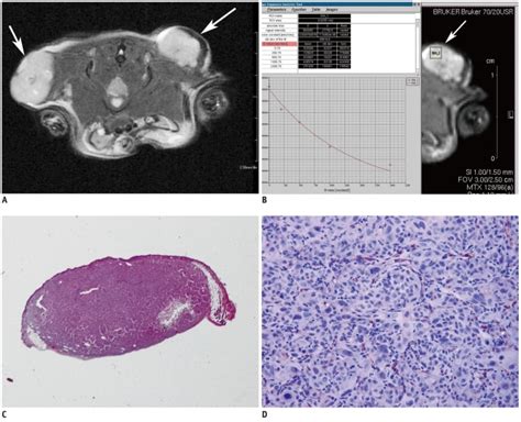 Human Prostate Cancer Cell Pc 3 Induced Bilateral Subcutaneous Tumors