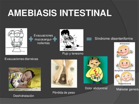 Amebiasis