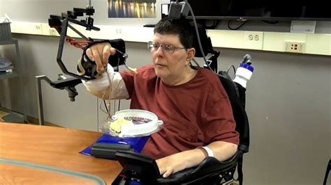 Implant Allows Paralyzed Man To Move Arm Using His Thoughts Hd Youtube