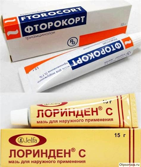 Методы лечения псориаза – современные и эффективные способы
