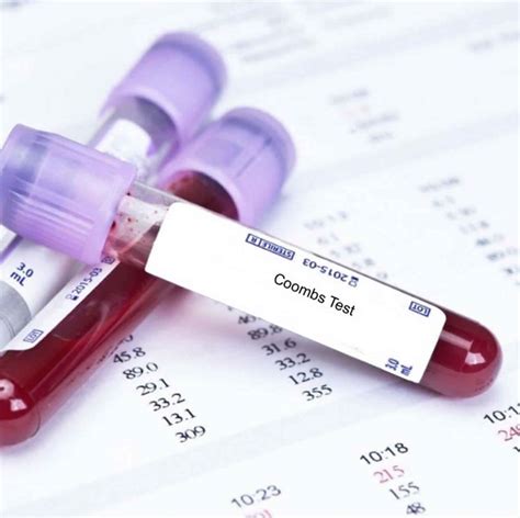 Coombs Test In Newborn Indirect Coombs Test And Direct Coombs Test