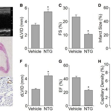 Continuous Nitroglycerin NTG Infusion Induces Akt Snitrosylation And