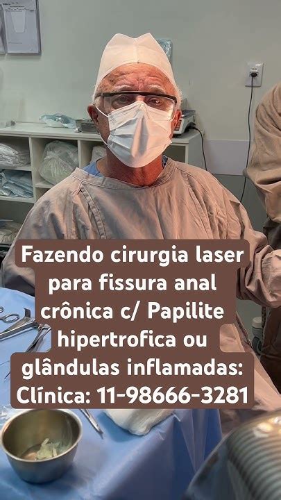 Fazendo Cirurgia Laser Fissura Anal C Glândulas Inflamadas E Plicoma