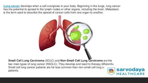 Lung Cancer: Symptoms, Causes, Risks, and Treatment | PPT