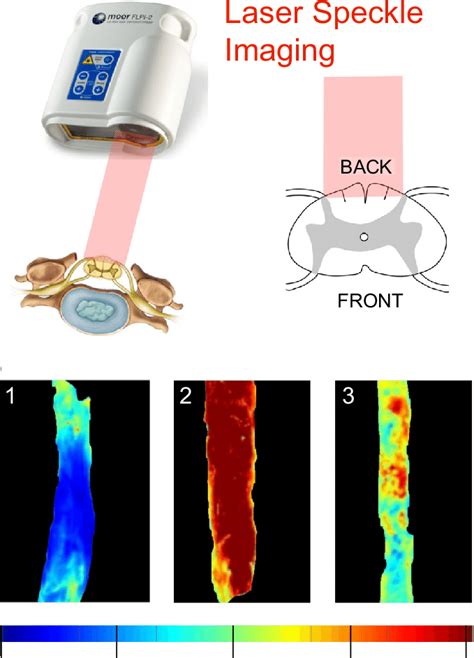 Imaging Spinal Cord Blood Flow During Surgery A Schematic Of Setup