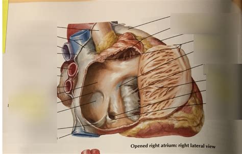 Cv Anatomy Practical Heart Netters 3 Diagram Quizlet