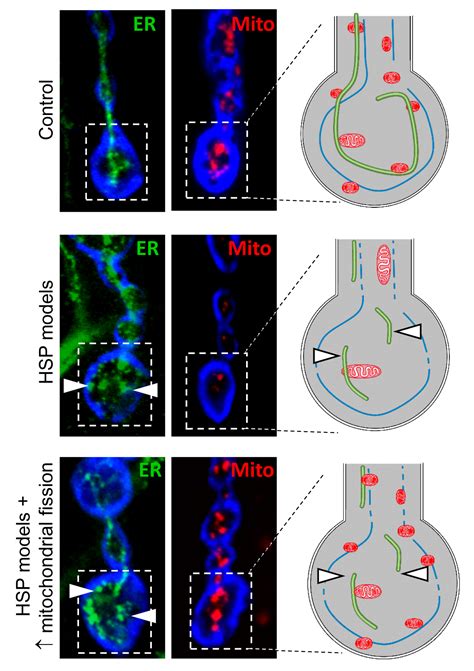 Rare Disease Models Provide Insight Into Inherited Forms Of Motor