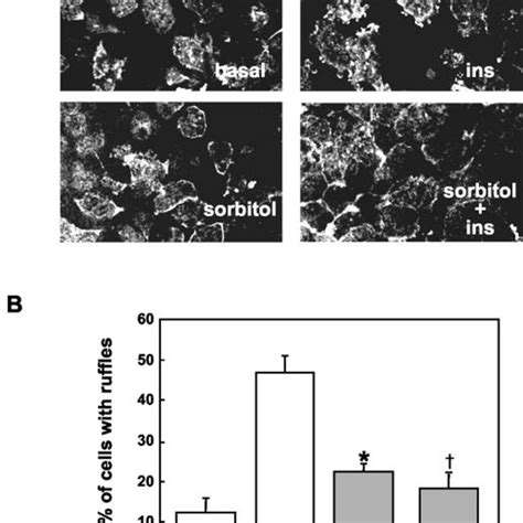 Hyperosmotic Stress Strongly Inhibits Insulin Induced Membrane