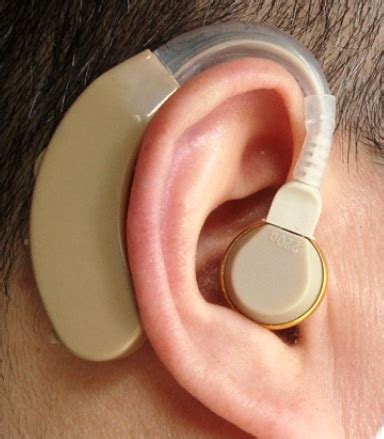 Axon F Bte Hearing Aid Machine Price In Bangladesh Bdstall