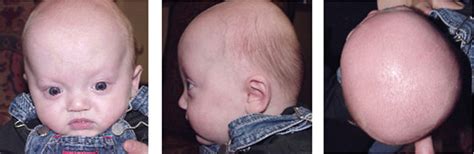 Before and After Photos | Cranial Center