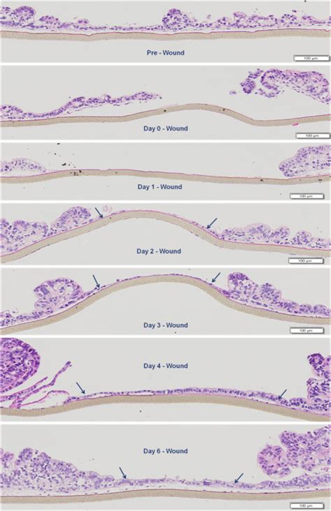 Epithelial Restitution Mattek Life Sciences