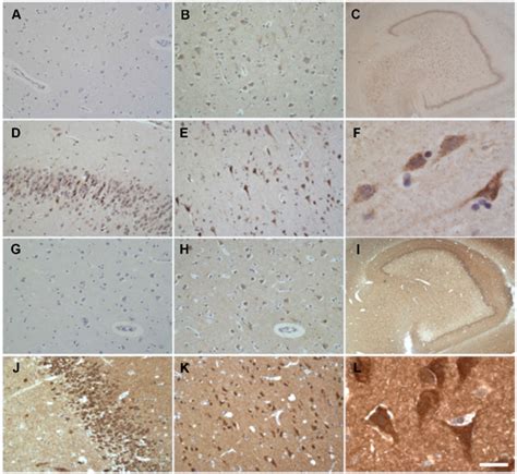 Immunohistochemical Detection Of Neuronal Cad A F And Dhodh G L In