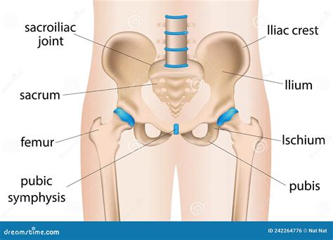 Illustration Of Painful Hip Sacral Inflammation Stock Vector