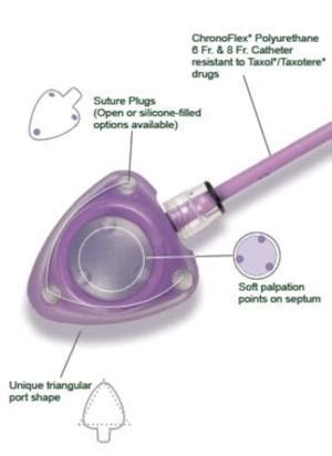 Defective Medical Device Bard PowerPort Catheter Lawsuit - Neumann Law ...