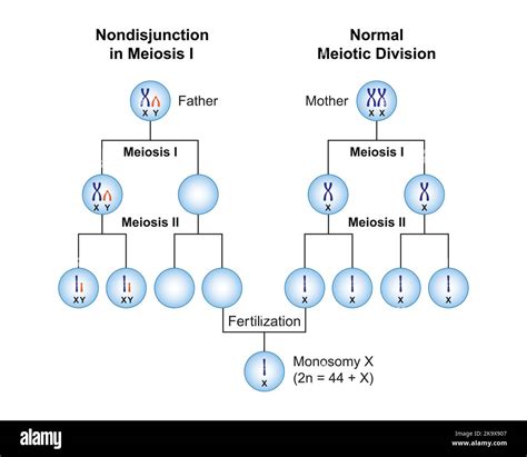 Conception Scientifique De La Non Disjonction En Monosomie X Syndrome