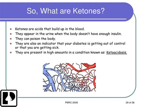 What Causes Ketones To Be Low At Andres Anderson Blog