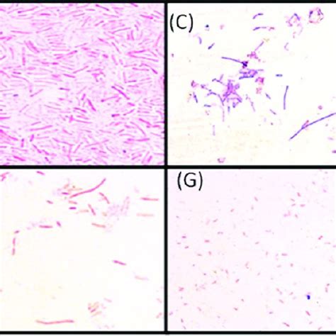 √100以上 E Coli Morphology Gram Stain 283207 Li Gram Stain Morphology And Arrangement